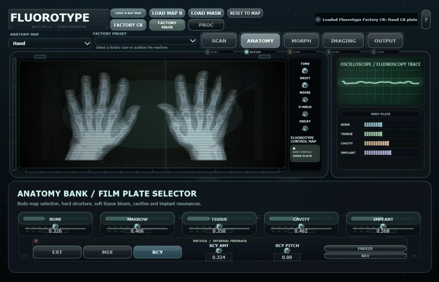 Fluorotype Anatomy bank with film plate selector and recycle controls